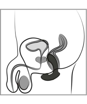 ANOS - Prostata Buttplug med Vibrasjoner
